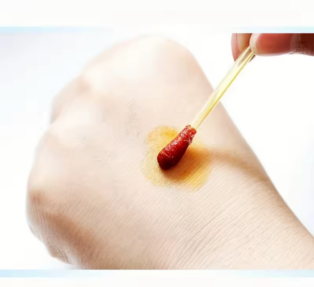 Iodine Swabs To Disinfect the Wound - 50 Swabs
